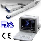 3probe 190891211156 Carejoy Ultrasound Scanner Machine Ultrasonic