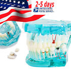 190891413345 Denshine Ce Dental Tooth Transparent Adult Pathological Teeth