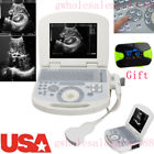 190891422491 Carejoy New Ce Notebook Ultrasound Scanner Machine Convex