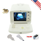 Rus-6000a Carejoy Ce Digital Ultrasound Scanner Convex Linear Probes Ultrasonography