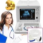 Rus-6000d Carejoy Digital Ultrasound Machine Scanner Convex Probe Worksaton 190891420039