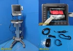 2014 Fujifilm Sonosite S-narve Ultrasound W/ L25X Probe, Printer & Stand 38587. Fixed Price $3178.00.