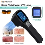 308NM Excimer Laser Treatment Device Handheld Uvb For Skin Disorders Home Use. Fixed Price $1099.69.