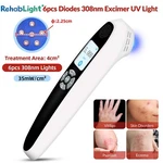 Portable 308NM Excimer Laser For Home Use White Dots On Legs Light Treatment. Fixed Price $282.00.