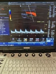 Ge Logiq BT12 R7 All Options Active With Convex And Linear Probes. Fixed Price $8999.00.