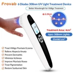 308NM Excimer Laser Light Home Compact Skin Disorder Therapy For Conditions. Fixed Price $282.29.